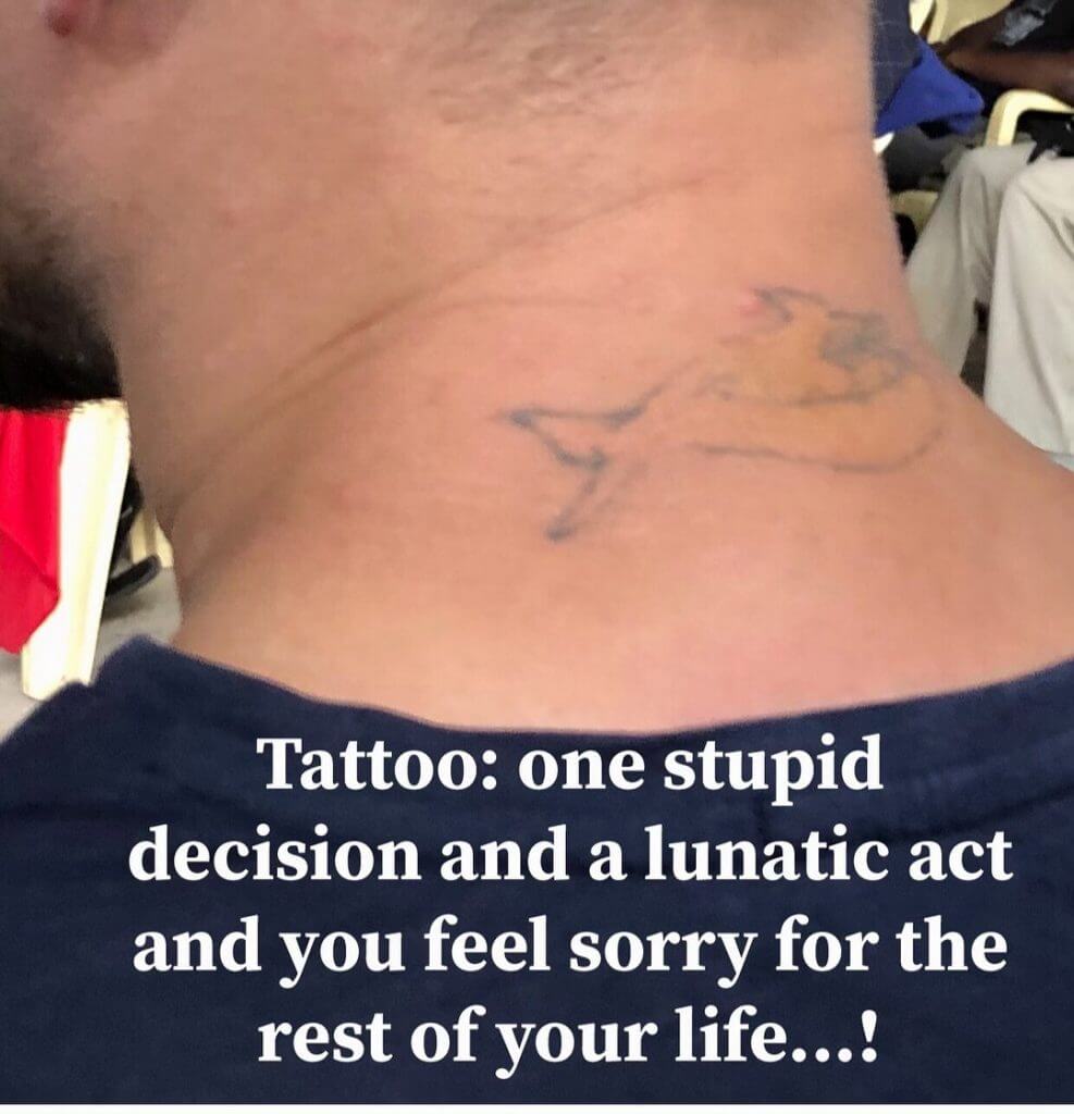 Failed tattoo on the neck